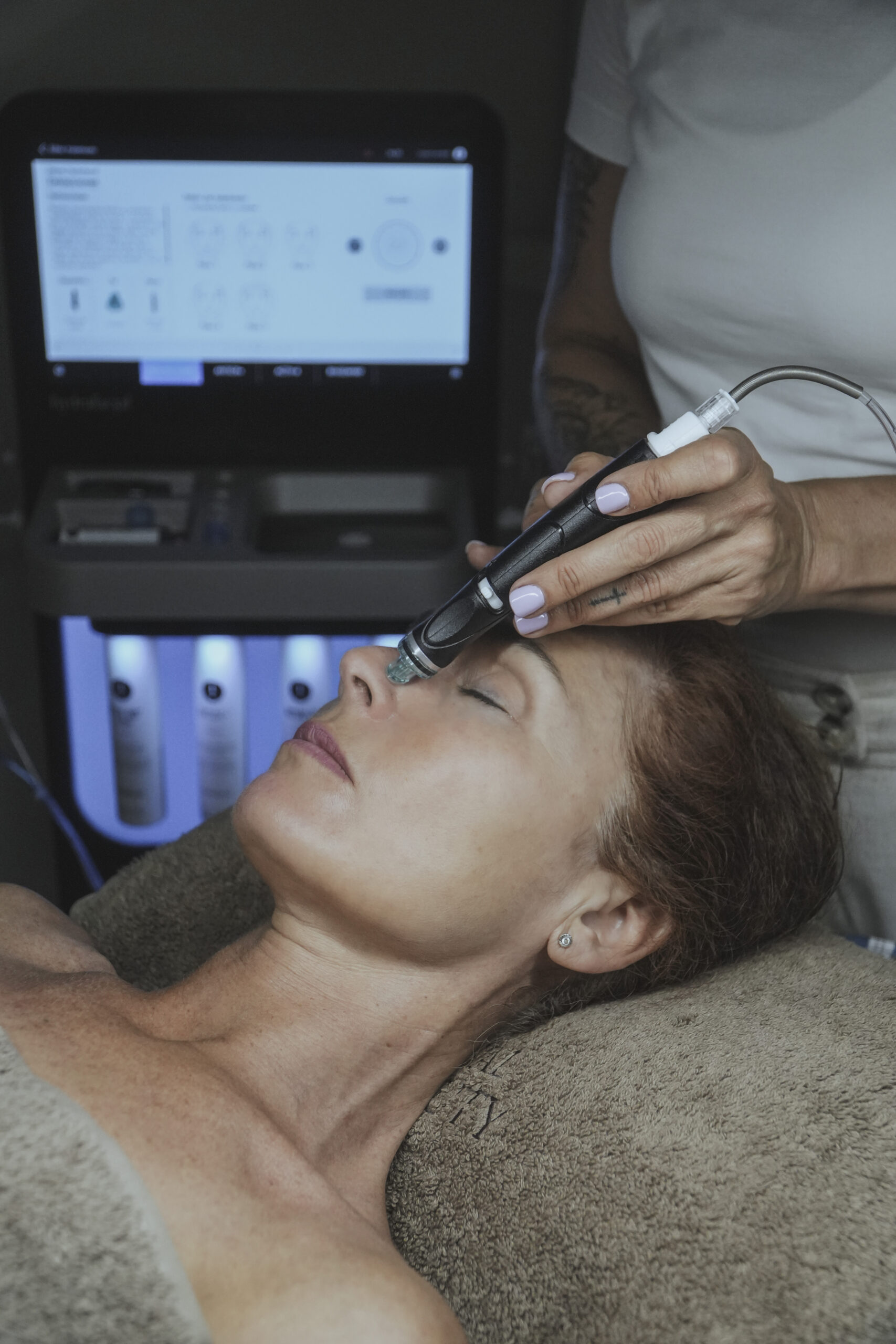 tratamiento faciales fuengirola